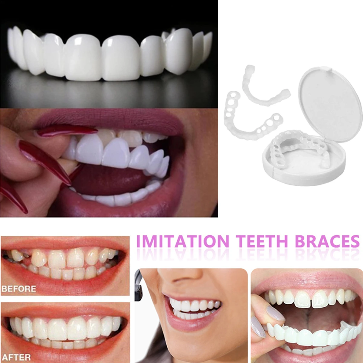 1 Pair Teeth ( 2 pcs) Veneers Whitening Dentures Imitation Braces Temporary False Teeth Cover Perfect Smile Comfortable Fit Denture Kit